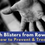 Ouch Blisters from Rowing! How to Prevent & Treat