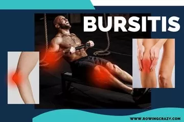 bursitis can affect different parts of the body